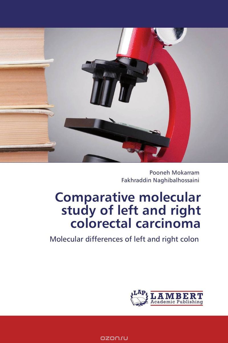 Скачать книгу "Comparative molecular study of left and right colorectal carcinoma"