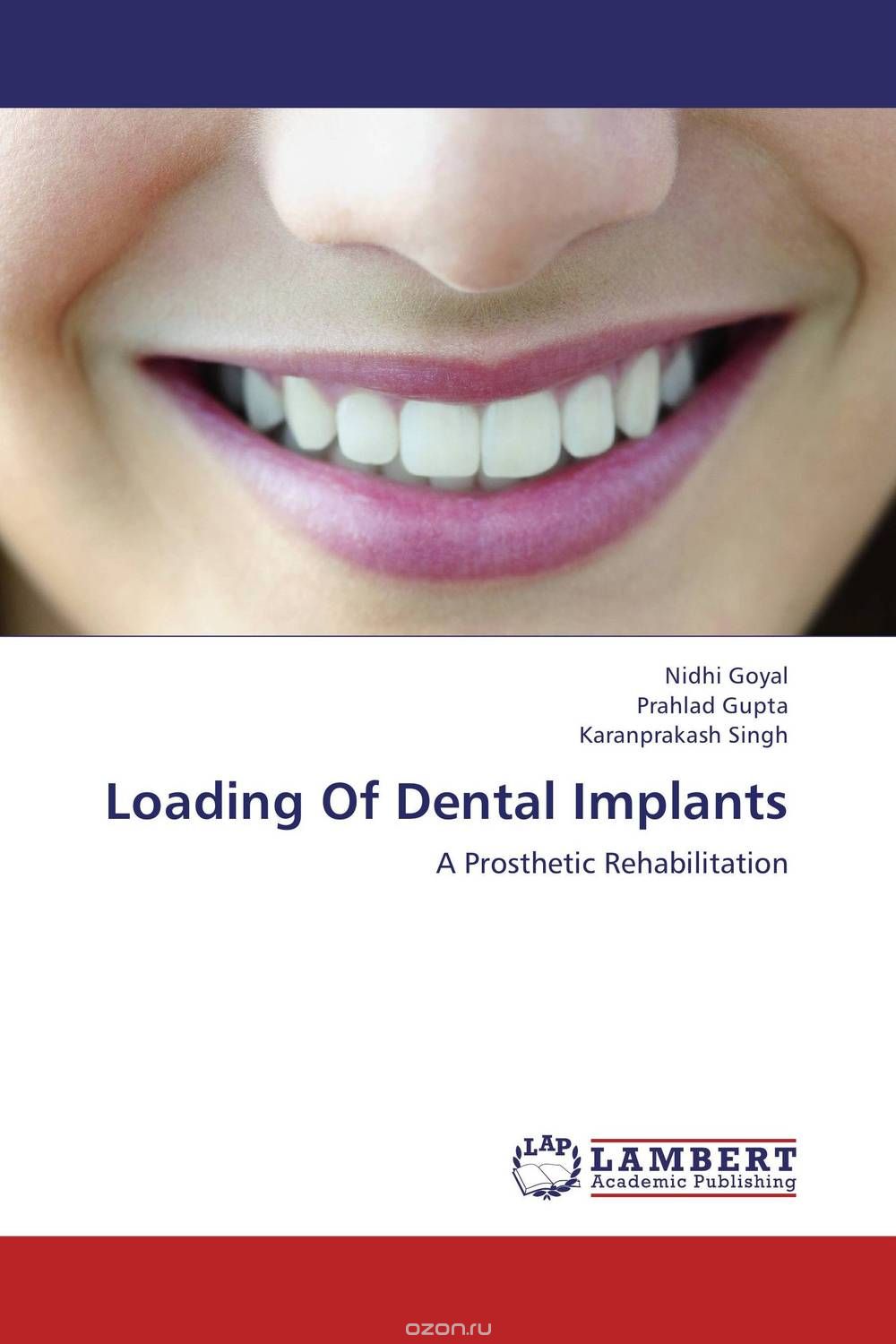 Скачать книгу "Loading Of Dental Implants"