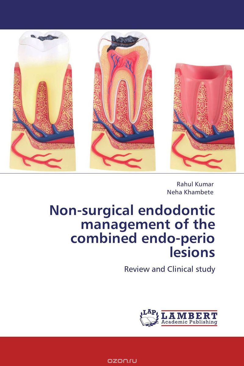 Скачать книгу "Non-surgical endodontic management of the combined endo-perio lesions"
